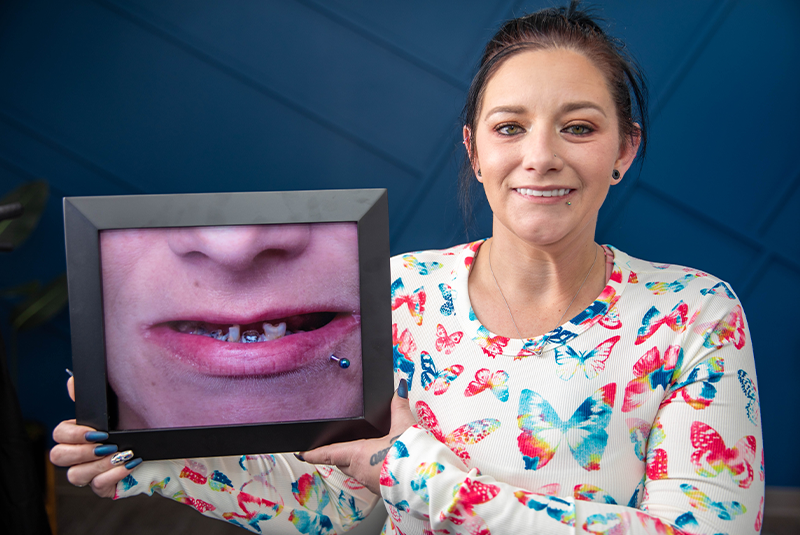 patient Somer holding her before photo and smiling